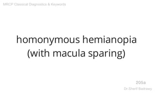 homonymous hemianopia
(with macula sparing)
205a
MRCP Classical Diagnostics & Keywords
Dr.Sherif Badrawy
 