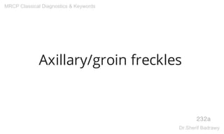 Axillary/groin freckles
232a
MRCP Classical Diagnostics & Keywords
Dr.Sherif Badrawy
 