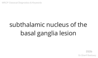 subthalamic nucleus of the
basal ganglia lesion
252b
MRCP Classical Diagnostics & Keywords
Dr.Sherif Badrawy
 