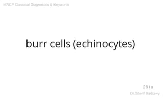 burr cells (echinocytes)
261a
MRCP Classical Diagnostics & Keywords
Dr.Sherif Badrawy
 
