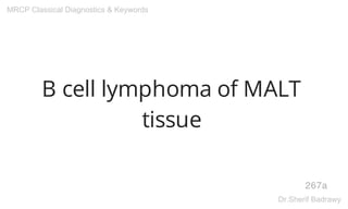 B cell lymphoma of MALT
tissue
267a
MRCP Classical Diagnostics & Keywords
Dr.Sherif Badrawy
 