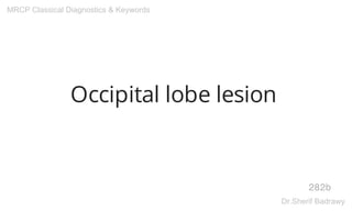 Occipital lobe lesion
282b
MRCP Classical Diagnostics & Keywords
Dr.Sherif Badrawy
 