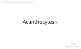 Acanthocytes -
283a
MRCP Classical Diagnostics & Keywords
Dr.Sherif Badrawy
 