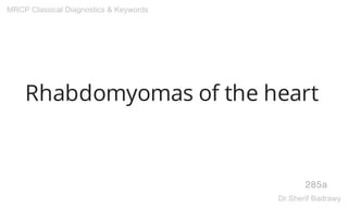 Rhabdomyomas of the heart
285a
MRCP Classical Diagnostics & Keywords
Dr.Sherif Badrawy
 
