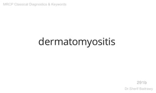 dermatomyositis
291b
MRCP Classical Diagnostics & Keywords
Dr.Sherif Badrawy
 