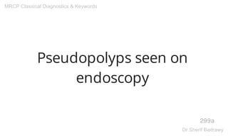 Pseudopolyps seen on
endoscopy
299a
MRCP Classical Diagnostics & Keywords
Dr.Sherif Badrawy
 