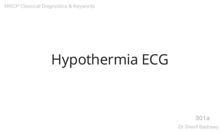 Hypothermia ECG
301a
MRCP Classical Diagnostics & Keywords
Dr.Sherif Badrawy
 