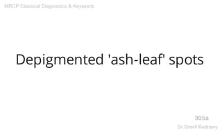 Depigmented 'ash-leaf' spots
305a
MRCP Classical Diagnostics & Keywords
Dr.Sherif Badrawy
 