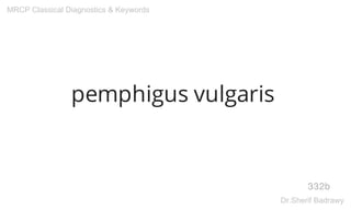 pemphigus vulgaris
332b
MRCP Classical Diagnostics & Keywords
Dr.Sherif Badrawy
 