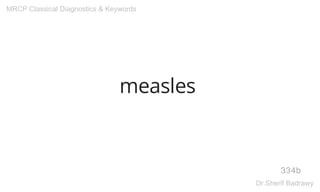 measles
334b
MRCP Classical Diagnostics & Keywords
Dr.Sherif Badrawy
 