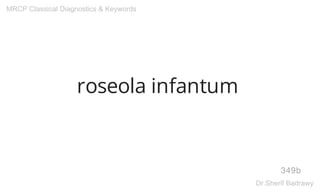 roseola infantum
349b
MRCP Classical Diagnostics & Keywords
Dr.Sherif Badrawy
 
