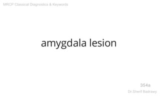 amygdala lesion
354a
MRCP Classical Diagnostics & Keywords
Dr.Sherif Badrawy
 