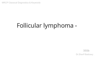 Follicular lymphoma -
355b
MRCP Classical Diagnostics & Keywords
Dr.Sherif Badrawy
 
