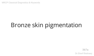 Bronze skin pigmentation
367a
MRCP Classical Diagnostics & Keywords
Dr.Sherif Badrawy
 