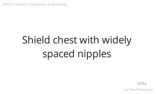 Shield chest with widely
spaced nipples
368a
MRCP Classical Diagnostics & Keywords
Dr.Sherif Badrawy
 