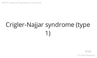 Crigler-Najjar syndrome (type
1)
372b
MRCP Classical Diagnostics & Keywords
Dr.Sherif Badrawy
 