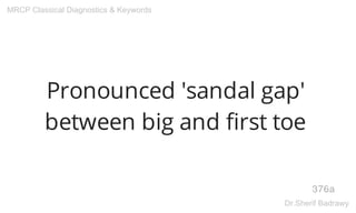 Pronounced 'sandal gap'
between big and first toe
376a
MRCP Classical Diagnostics & Keywords
Dr.Sherif Badrawy
 