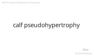 calf pseudohypertrophy
380a
MRCP Classical Diagnostics & Keywords
Dr.Sherif Badrawy
 