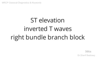ST elevation
inverted T waves
right bundle branch block
386a
MRCP Classical Diagnostics & Keywords
Dr.Sherif Badrawy
 