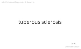 tuberous sclerosis
389b
MRCP Classical Diagnostics & Keywords
Dr.Sherif Badrawy
 