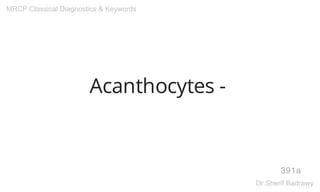 Acanthocytes -
391a
MRCP Classical Diagnostics & Keywords
Dr.Sherif Badrawy
 