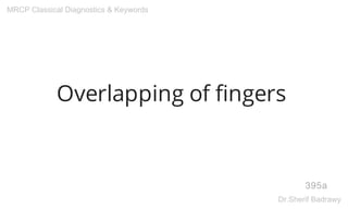 Overlapping of fingers
395a
MRCP Classical Diagnostics & Keywords
Dr.Sherif Badrawy
 