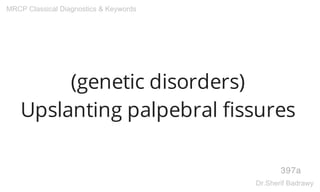 (genetic disorders)
Upslanting palpebral fissures
397a
MRCP Classical Diagnostics & Keywords
Dr.Sherif Badrawy
 