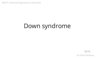 Down syndrome
397b
MRCP Classical Diagnostics & Keywords
Dr.Sherif Badrawy
 