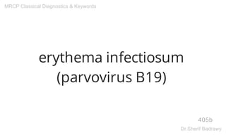 erythema infectiosum
(parvovirus B19)
405b
MRCP Classical Diagnostics & Keywords
Dr.Sherif Badrawy
 