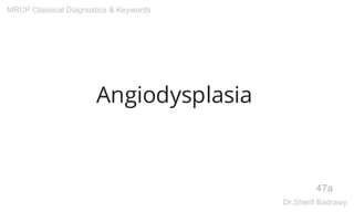 Angiodysplasia
47a
MRCP Classical Diagnostics & Keywords
Dr.Sherif Badrawy
 