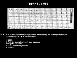MRCP April 2009 A 20 year old boy whose younger brother died suddenly last year requested for the ECG(shown above).What is the diagnosis 1. HOCM 2.  Arrhythmogenic Right ventricular dysplasia 3.Brugadas syndrome 4. Long QT interval syndrome 5. Acute MI Q:26 