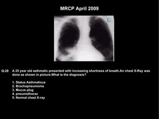 MRCP April 2009 A 25 year old asthmatic presented with increasing shortness of breath.An chest X-Ray was done as shown in picture.What is the diagnosis? 1. Status Asthmaticus 2. Brochopneumonia 3. Mucus plug 4. pneumothorax 5. Normal chest X-ray Q:28 