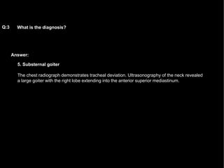 Answer: What is the diagnosis?   Q:3 5. Substernal goiter The chest radiograph demonstrates tracheal deviation. Ultrasonography of the neck revealed a large goiter with the right lobe extending into the anterior superior mediastinum.  