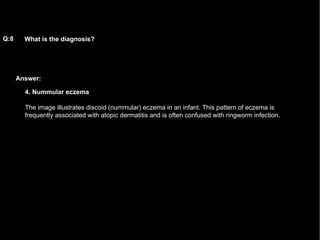 Answer: What is the diagnosis?   Q:8 4. Nummular eczema The image illustrates discoid (nummular) eczema in an infant. This pattern of eczema is frequently associated with atopic dermatitis and is often confused with ringworm infection.  
