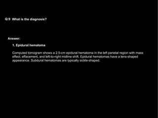 Answer: What is the diagnosis?   Q:9 1. Epidural hematoma Computed tomogram shows a 2.5-cm epidural hematoma in the left parietal region with mass effect, effacement, and left-to-right midline shift. Epidural hematomas have a lens-shaped appearance. Subdural hematomas are typically sickle-shaped. 