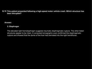 Answer: This patient presented following a high-speed motor vehicle crash. Which structure has been disrupted?   Q:10 2. Diaphragm The elevated right hemidiaphragm suggests traumatic diaphragmatic rupture. The other listed structures appear to be intact. A computed tomographic scan confirmed the diaphragmatic rupture and showed that the dome of the liver had herniated into the right hemithorax.  
