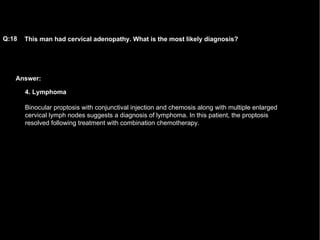 Answer: This man had cervical adenopathy. What is the most likely diagnosis?   Q:18 4. Lymphoma Binocular proptosis with conjunctival injection and chemosis along with multiple enlarged cervical lymph nodes suggests a diagnosis of lymphoma. In this patient, the proptosis resolved following treatment with combination chemotherapy.  