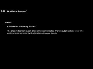 Answer: What is the diagnosis?   Q:24 4. Idiopathic pulmonary fibrosis The chest radiograph reveals bilateral reticular infiltrates. There is subpleural and lower-lobe predominance, consistent with idiopathic pulmonary fibrosis.  