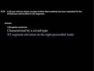Answer: A 20 year old boy whose younger brother died suddenly last year requested for the ECG(shown above).What is the diagnosis Q:26 3.Brugadas syndrome Characterized by a coved-type  ST-segment elevation in the right precordial leads   