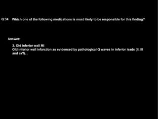 Answer: Which one of the following medications is most likely to be responsible for this finding?   Q:34 3. Old inferior wall MI   Old inferior wall infarction as evidenced by pathological Q waves in inferior leads (II, III and aVf).  . 
