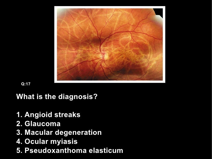 Esophageal Carcinoma Q16 18 Esophageal Carcinoma Q16 18
