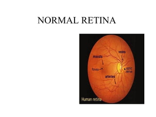 NORMAL RETINA  