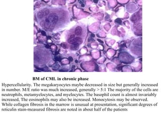 BM of CML in chronic phase Hypercellularity. The megakaryocytes maybe decreased in size but generally increased in number. M/E ratio was much increased, generally > 5:1 The majority of the cells are neutrophils, metamyelocytes, and myelocytes. The basophil count is almost invariably increased, The eosinophils may also be increased. Monocytosis may be observed. While collagen fibrosis in the marrow is unusual at presentation, significant degrees of reticulin stain-measured fibrosis are noted in about half of the patients 