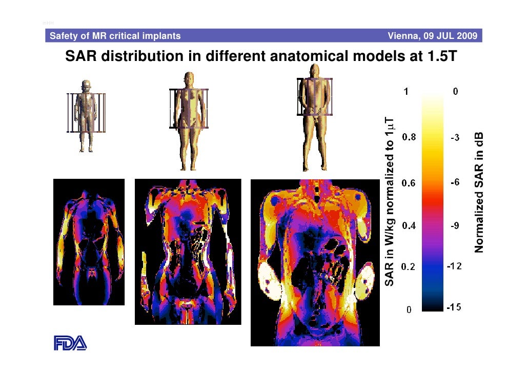 Safety of MRI Critical Medical Devices