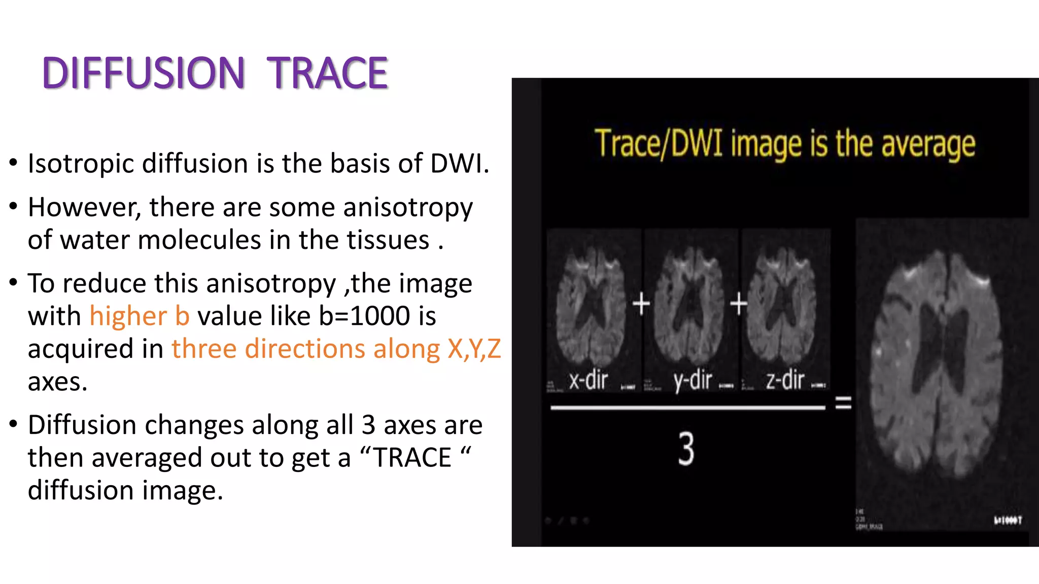 DIFFUSION TRACE
• Isotropic diffusion is the basis of DWI.
• However, there are some anisotropy
of water molecules in the tissues .
• To reduce this anisotropy ,the image
with higher b value like b=1000 is
acquired in three directions along X,Y,Z
axes.
• Diffusion changes along all 3 axes are
then averaged out to get a “TRACE “
diffusion image.
 