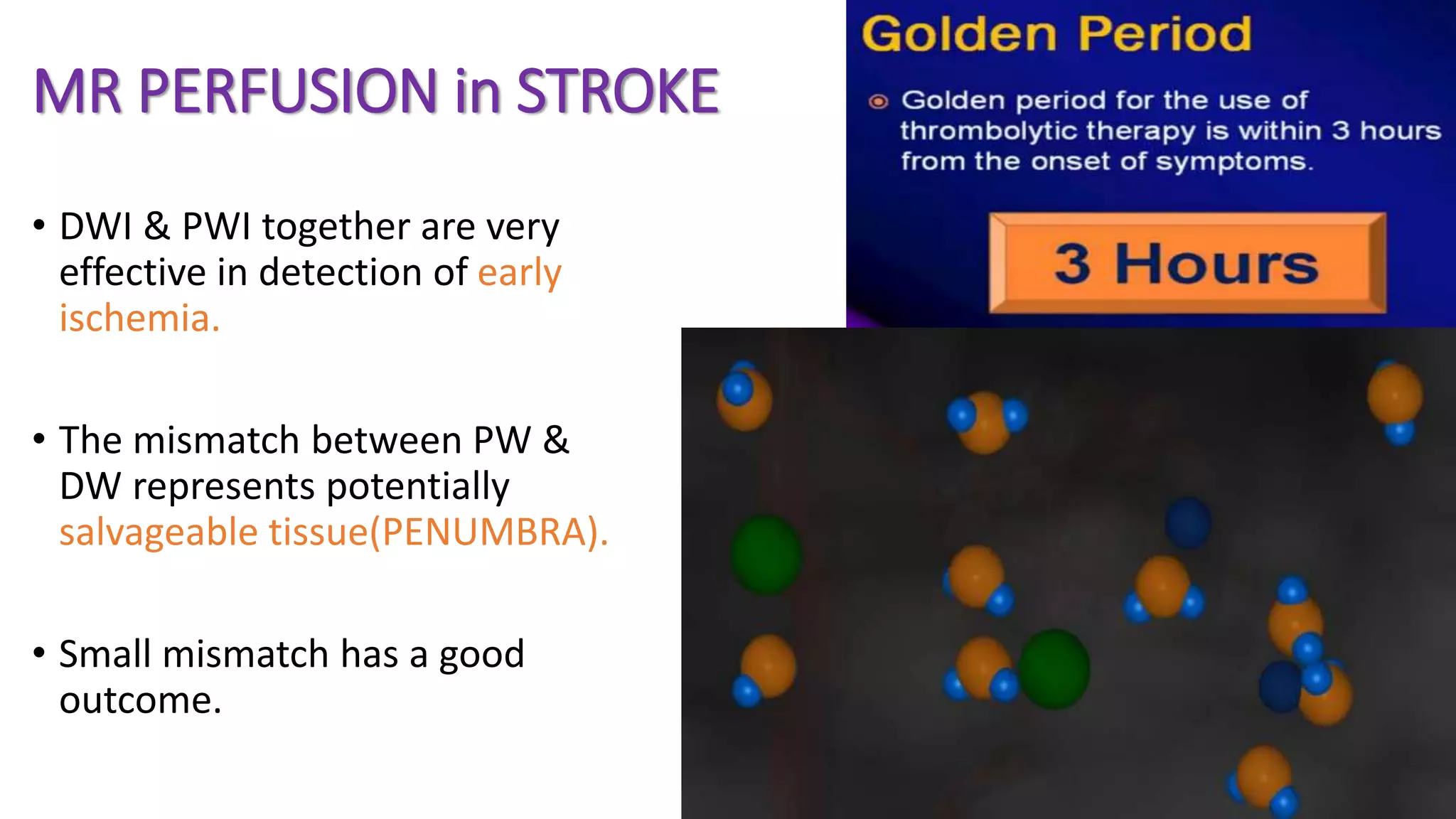 MR PERFUSION in STROKE
• DWI & PWI together are very
effective in detection of early
ischemia.
• The mismatch between PW &
DW represents potentially
salvageable tissue(PENUMBRA).
• Small mismatch has a good
outcome.
 