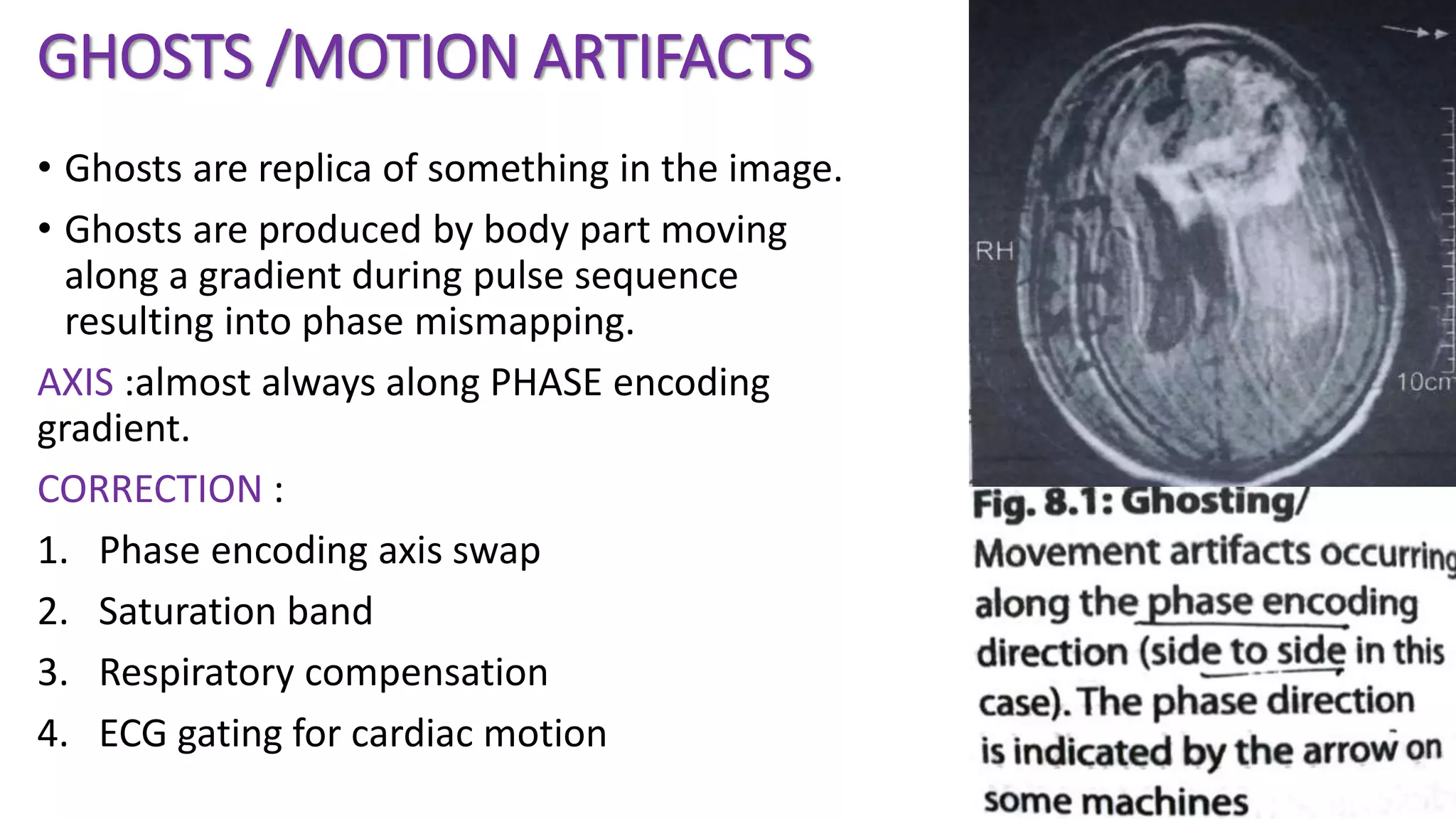 GHOSTS /MOTION ARTIFACTS
• Ghosts are replica of something in the image.
• Ghosts are produced by body part moving
along a gradient during pulse sequence
resulting into phase mismapping.
AXIS :almost always along PHASE encoding
gradient.
CORRECTION :
1. Phase encoding axis swap
2. Saturation band
3. Respiratory compensation
4. ECG gating for cardiac motion
 