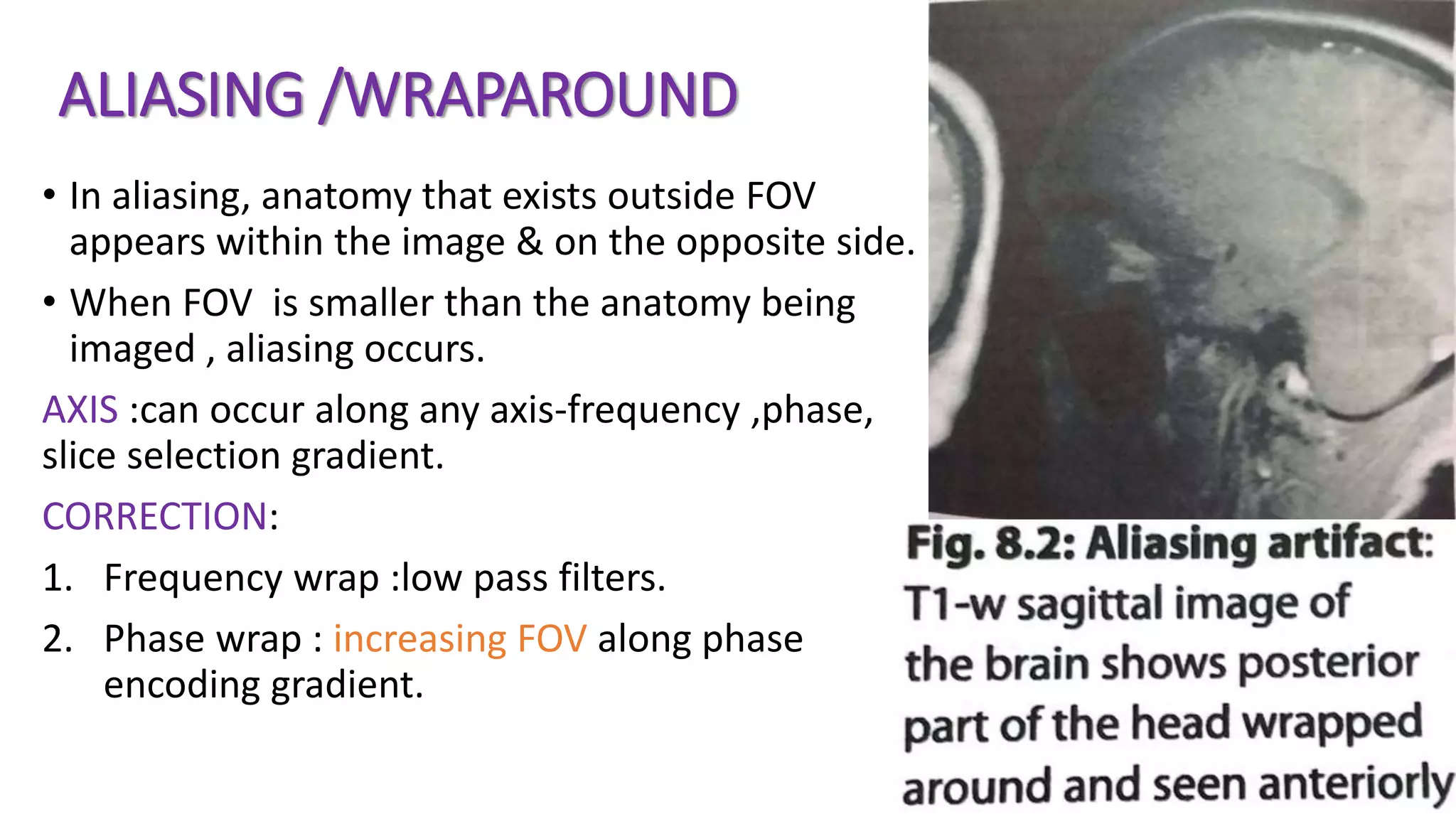 ALIASING /WRAPAROUND
• In aliasing, anatomy that exists outside FOV
appears within the image & on the opposite side.
• When FOV is smaller than the anatomy being
imaged , aliasing occurs.
AXIS :can occur along any axis-frequency ,phase,
slice selection gradient.
CORRECTION:
1. Frequency wrap :low pass filters.
2. Phase wrap : increasing FOV along phase
encoding gradient.
 