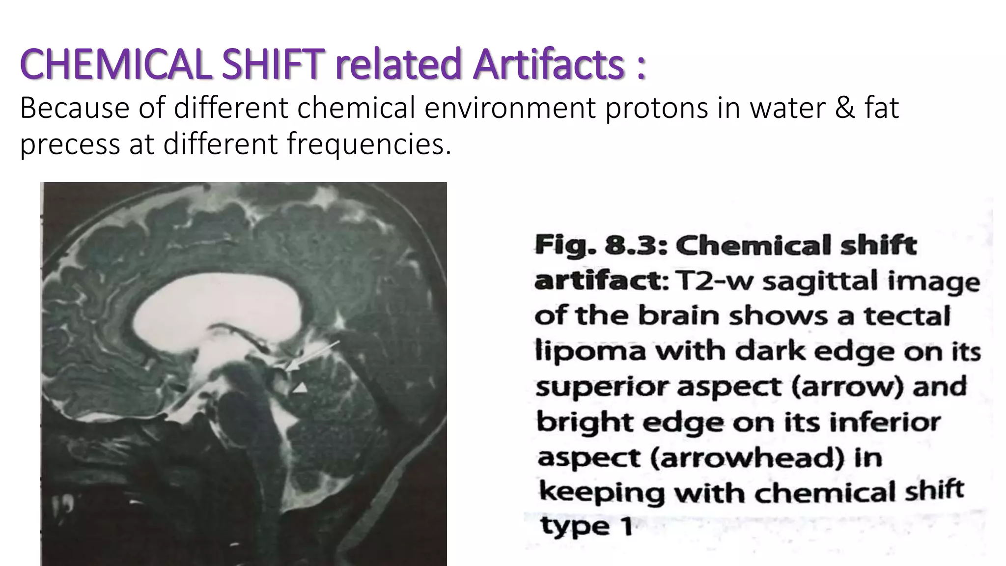 CHEMICAL SHIFT related Artifacts :
Because of different chemical environment protons in water & fat
precess at different frequencies.
 