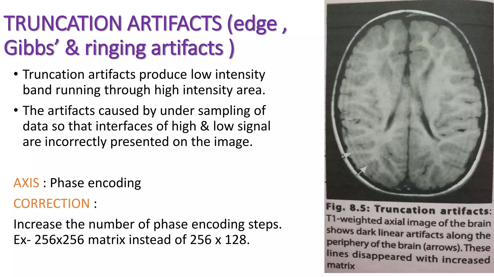 TRUNCATION ARTIFACTS (edge ,
Gibbs’ & ringing artifacts )
• Truncation artifacts produce low intensity
band running through high intensity area.
• The artifacts caused by under sampling of
data so that interfaces of high & low signal
are incorrectly presented on the image.
AXIS : Phase encoding
CORRECTION :
Increase the number of phase encoding steps.
Ex- 256x256 matrix instead of 256 x 128.
 